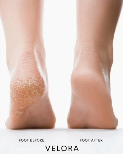 Velora Silk 3 Pro: Smooth Feet Instantly