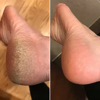 Customer